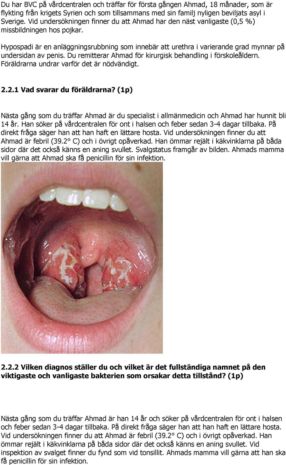 Hypospadi är en anläggningsrubbning som innebär att urethra i varierande grad mynnar på undersidan av penis. Du remitterar Ahmad för kirurgisk behandling i förskoleåldern.