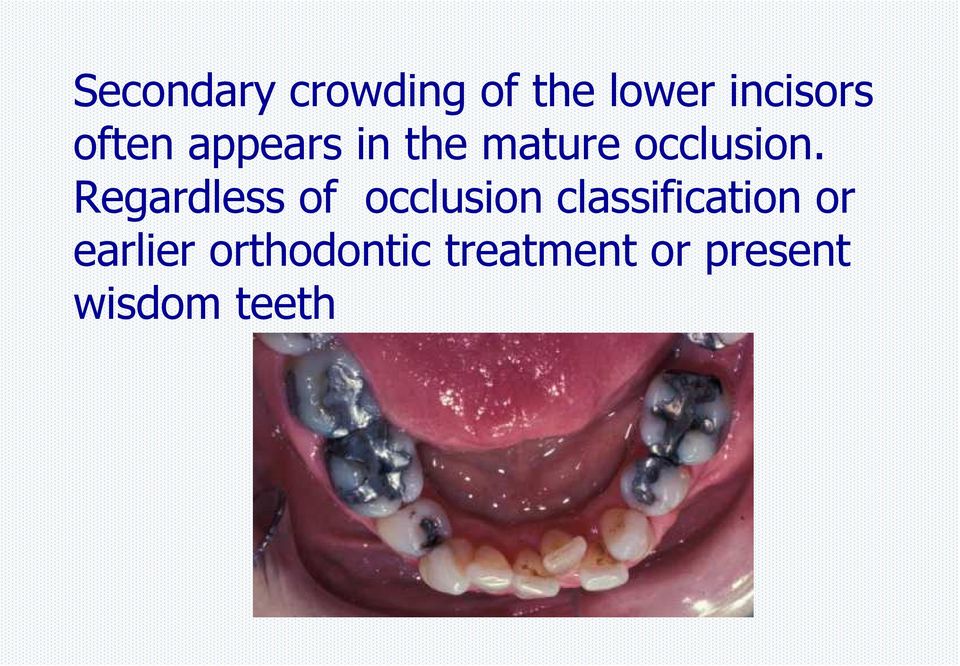 Regardless of occlusion classification or