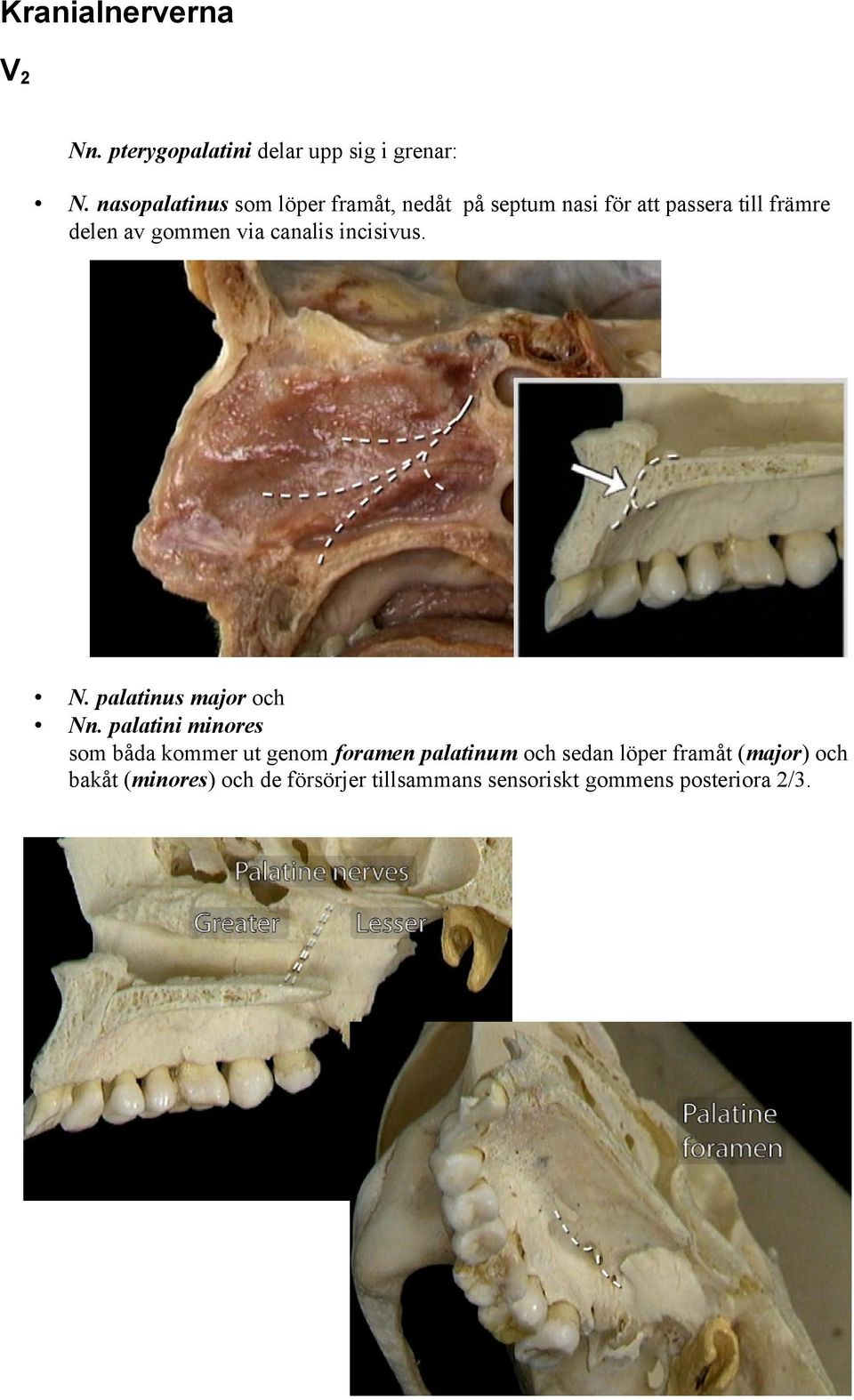 gommen via canalis incisivus. N. palatinus major och Nn.