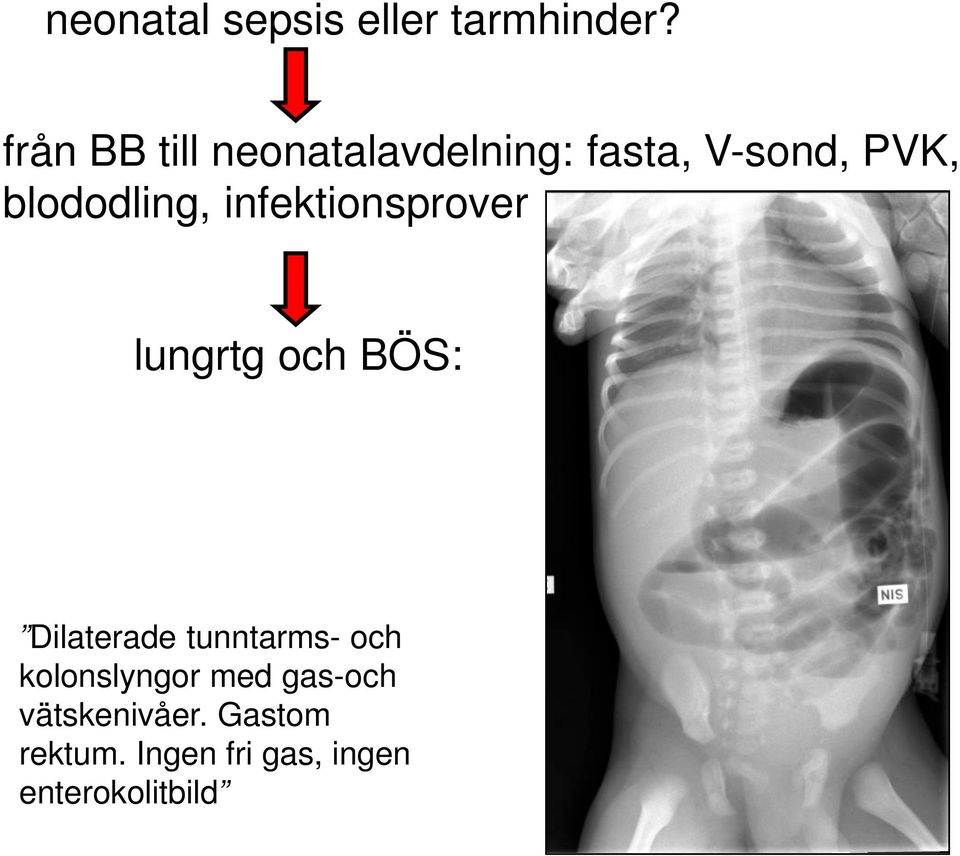 blododling, infektionsprover lungrtg och BÖS: Dilaterade