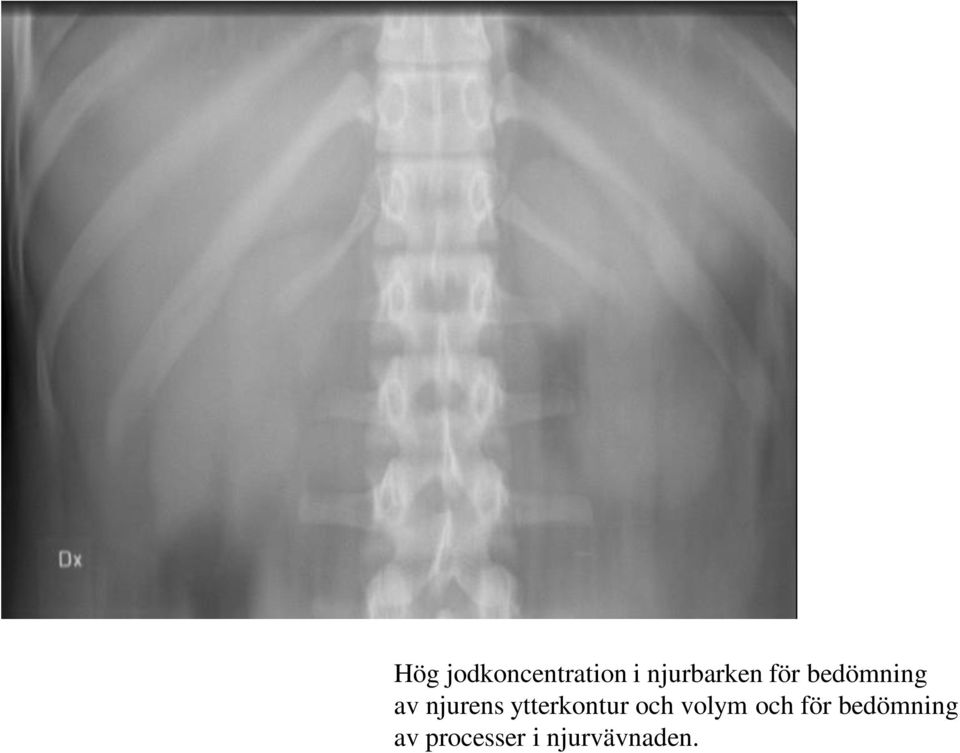 bedömning av njurens ytterkontur och