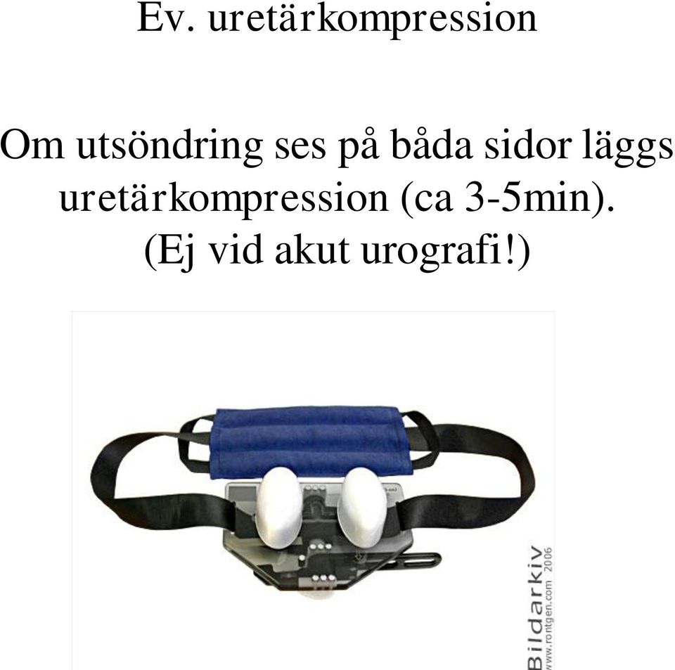 läggs uretärkompression (ca