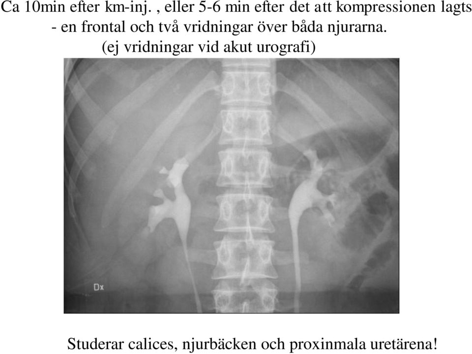 frontal och två vridningar över båda njurarna.