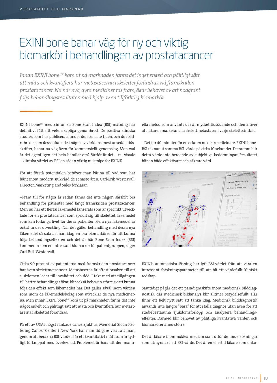 Nu när nya, dyra mediciner tas fram, ökar behovet av att noggrant följa behandlingsresultaten med hjälp av en tillförlitlig biomarkör.