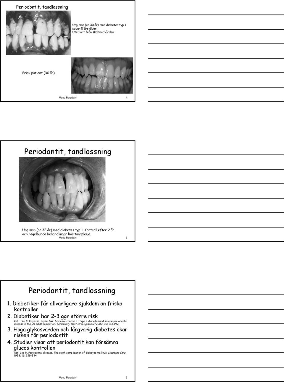 Maud Bergdahl 5 Periodontit, tandlossning 1. Diabetiker får allvarligare sjukdom än friska kontroller 2. Diabetiker har 2-3 ggr större risk Ref: Tsai C, Hayes C, Taylor GW.