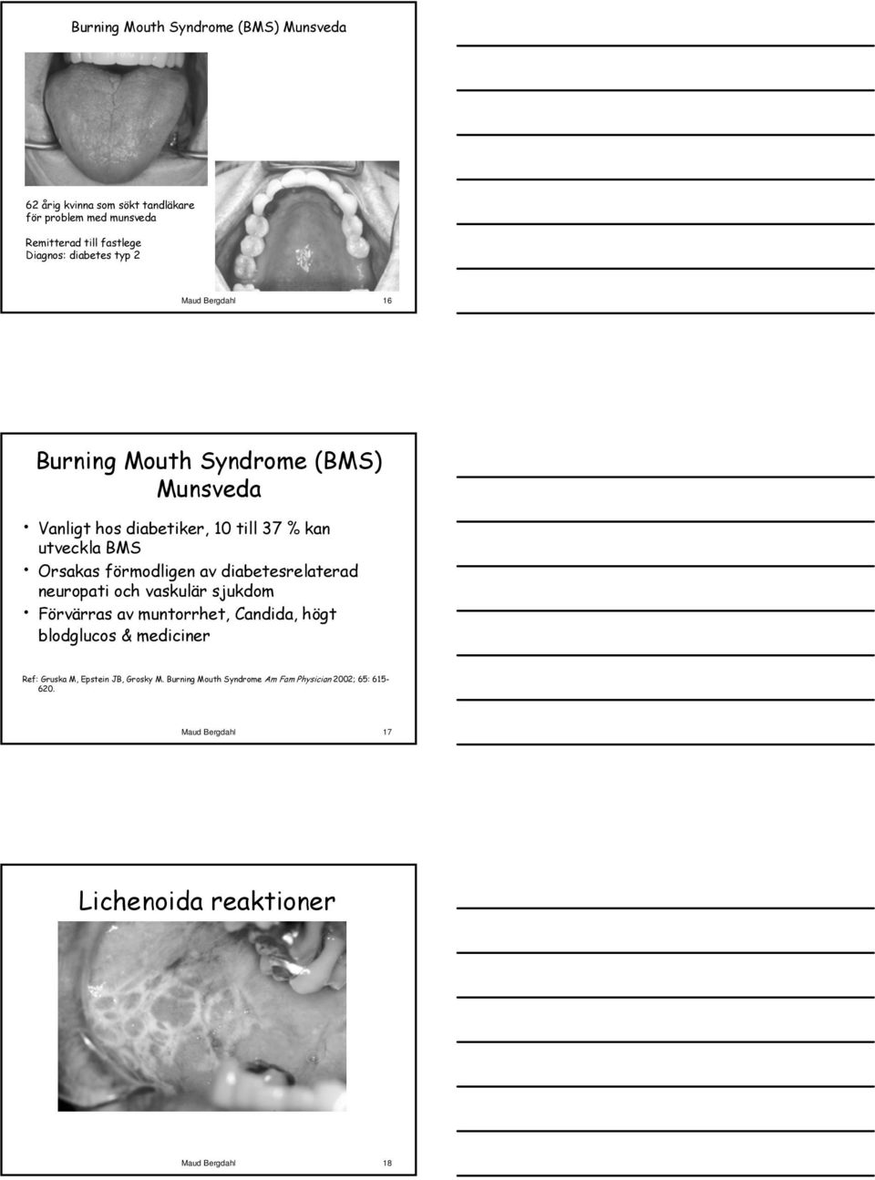 förmodligen av diabetesrelaterad neuropati och vaskulär sjukdom Förvärras av muntorrhet, Candida, högt blodglucos & mediciner Ref: