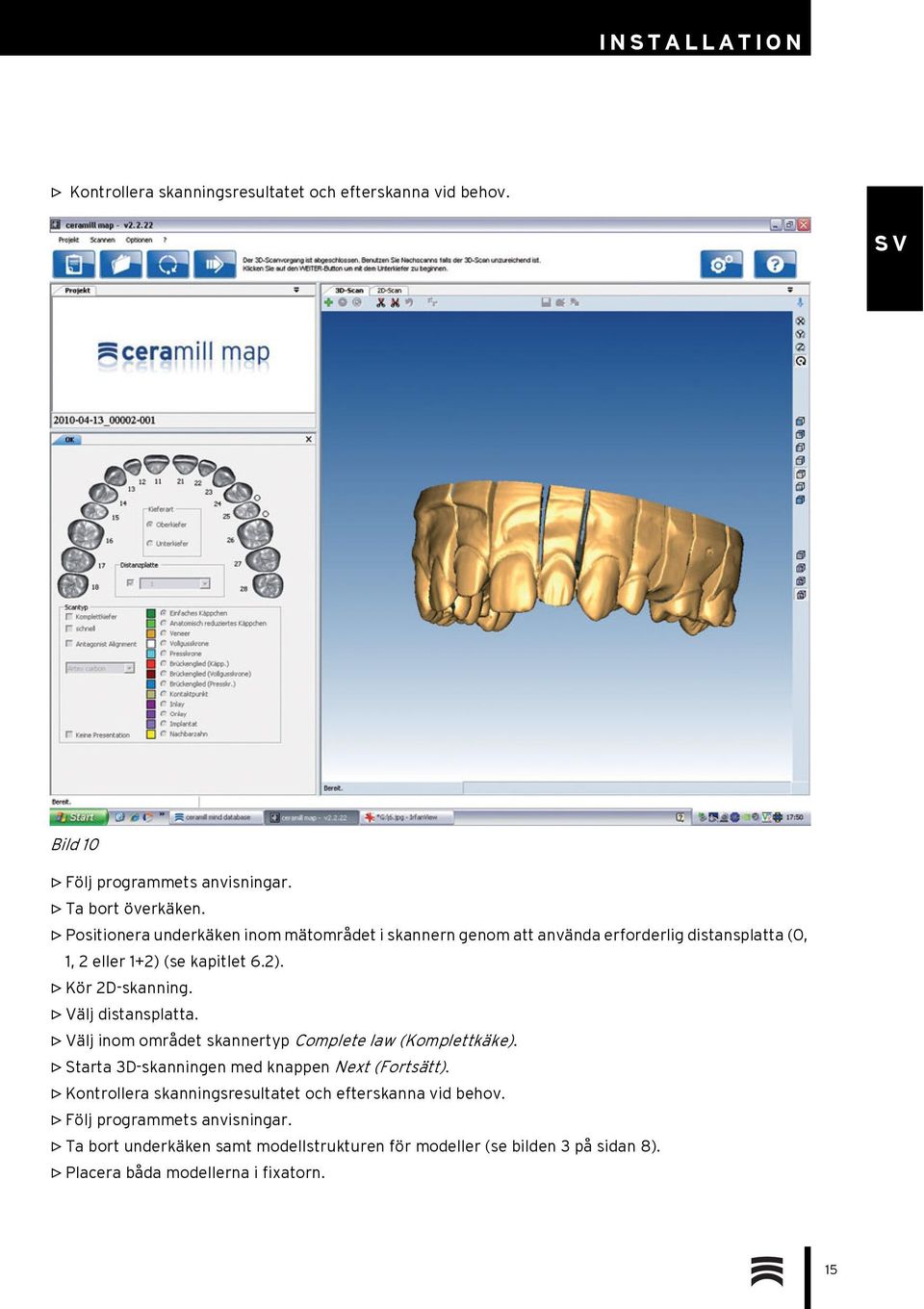 Välj distansplatta. Välj inom området skannertyp Complete law (Komplettkäke). Starta 3D-skanningen med knappen Next (Fortsätt).