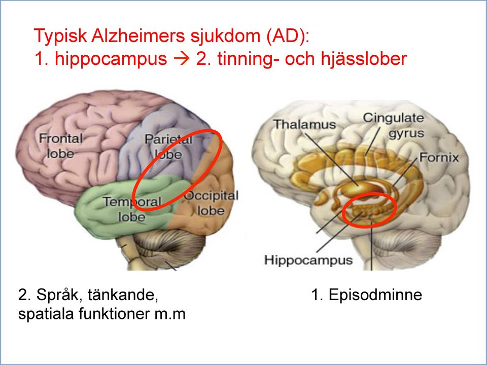 tinning- och hjässlober 2.