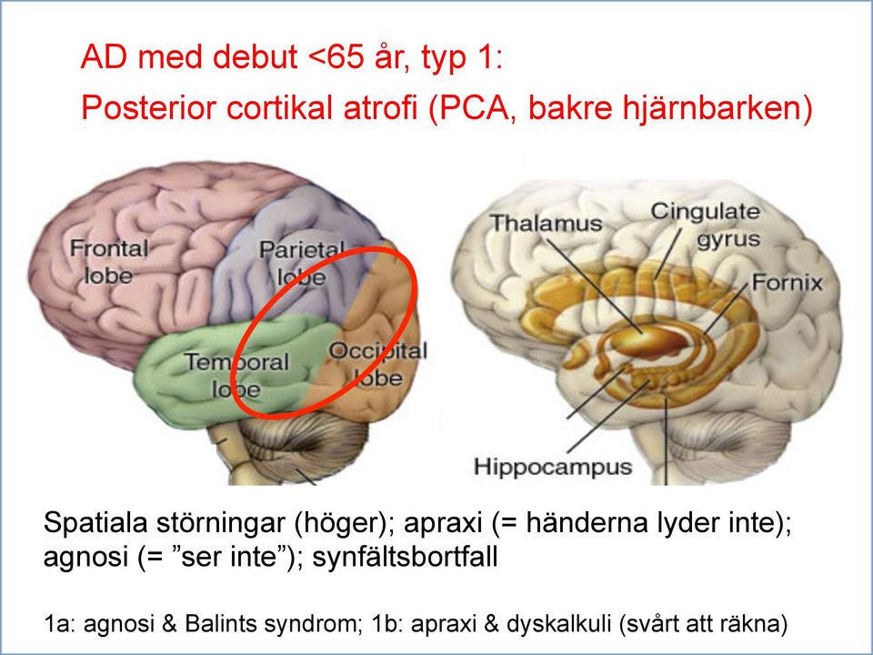 händerna lyder inte); agnosi (= ser inte ); synfältsbortfall