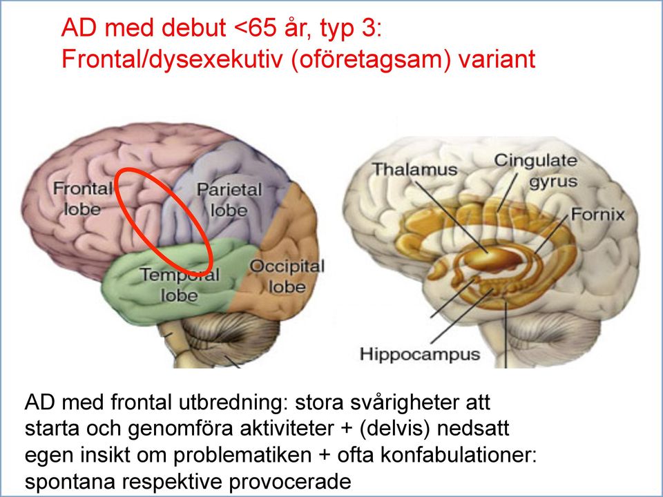 och genomföra aktiviteter + (delvis) nedsatt egen insikt om