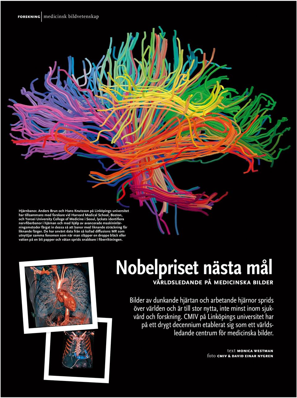 nervfiberbanor i hjärnan och med hjälp av avancerade maskininlärningsmetoder färgat in dessa så att banor med liknande sträckning får liknande färger.