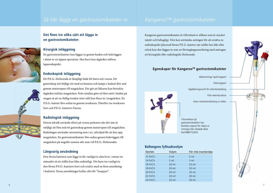 Ett gastroskop (ett böjligt rör med en kamera och lampa i änden) förs ned genom matstrupen till magsäcken. Det gör att läkaren kan betrakta åtgärden inifrån magsäcken.