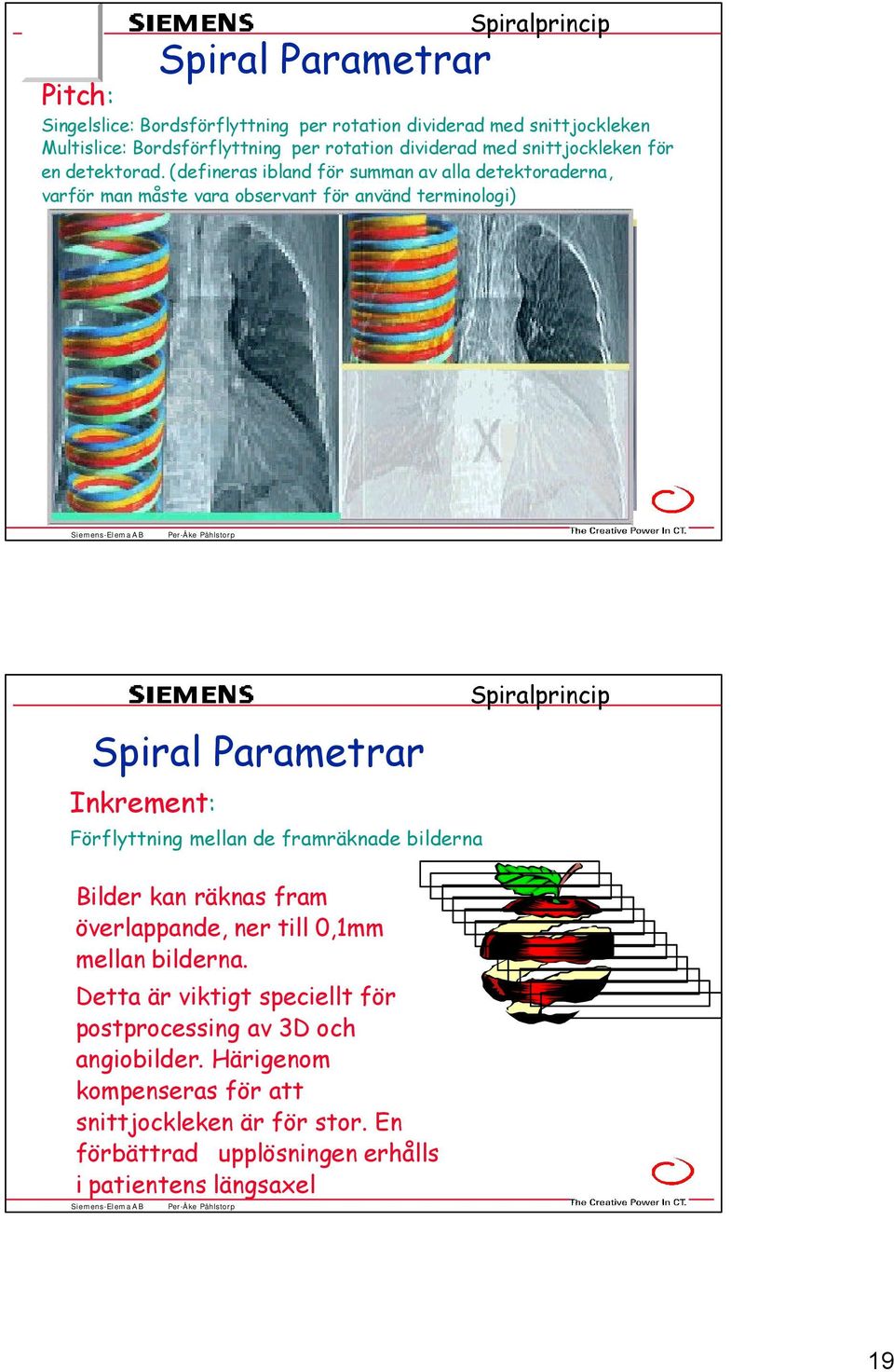 (defineras ibland för summan av alla detektoraderna, varför man måste vara observant för använd terminologi) Pitch = Bordsförflyttning / rotation snittjocklek Spiral Parametrar