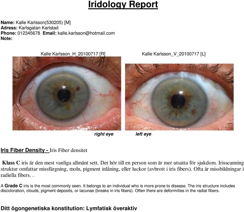 Det hör till en person som är mer utsatta för sjukdom. Irisscanning struktur omfattar missfärgning, moln, pigment inlåning, eller luckor (avbrott i iris fibers).