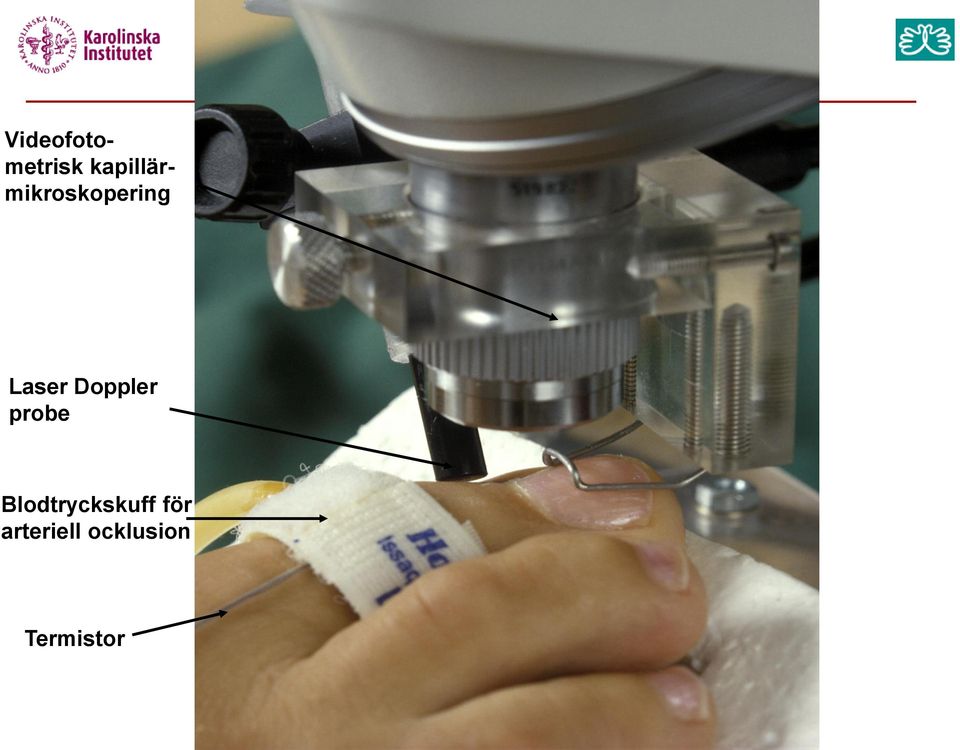 Laser Doppler probe