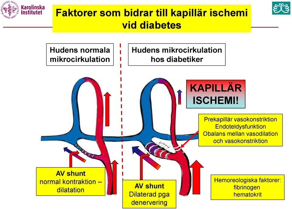 Prekapillär vasokonstriktion Endoteldysfunktion Obalans mellan vasodilation och