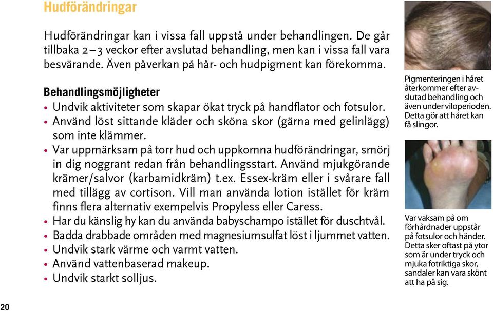 Använd löst sittande kläder och sköna skor (gärna med gelinlägg) som inte klämmer. Var uppmärksam på torr hud och uppkomna hudförändringar, smörj in dig noggrant redan från behandlingsstart.