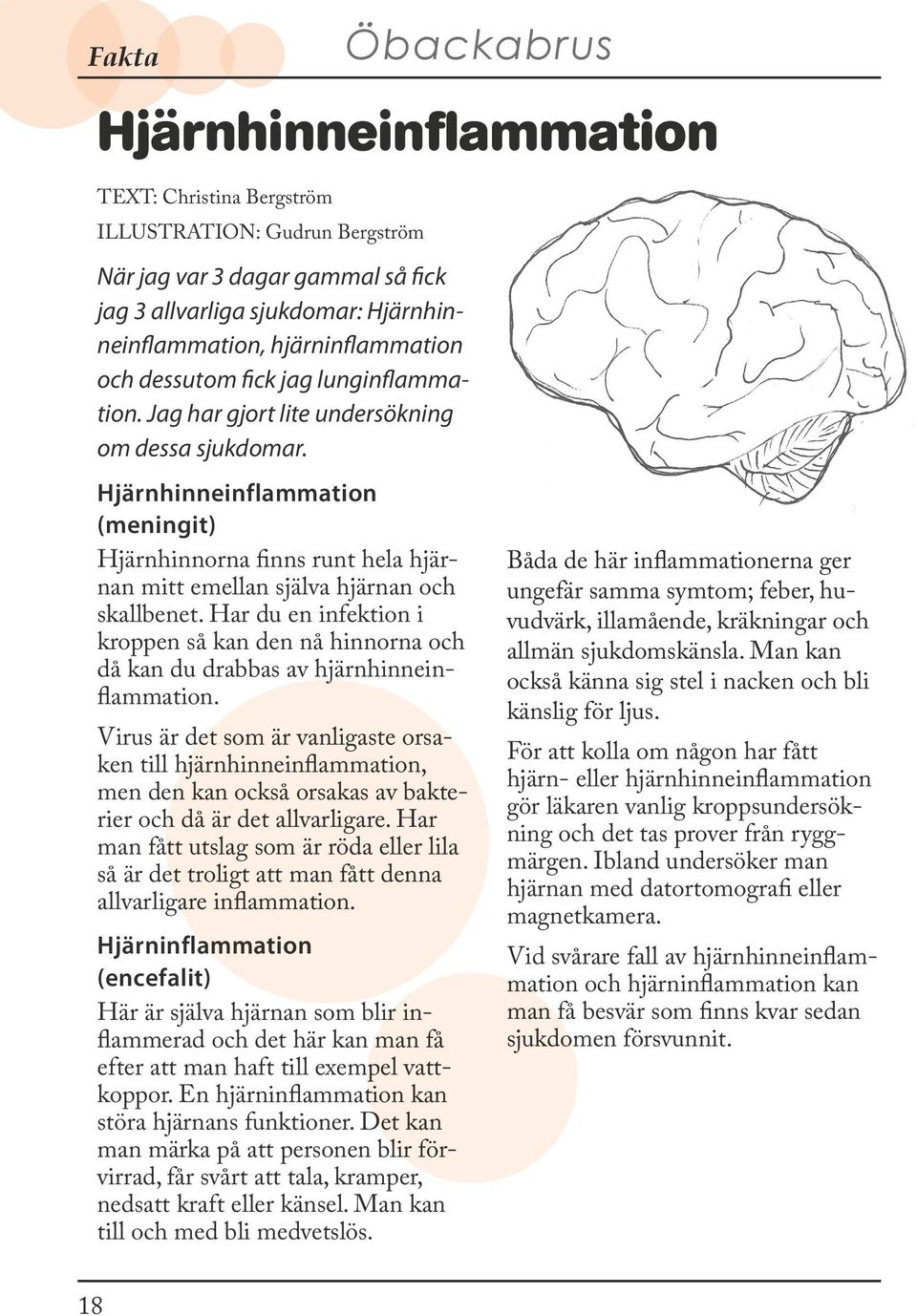 Hjärnhinneinflammation (meningit) Hjärnhinnorna finns runt hela hjärnan mitt emellan själva hjärnan och skallbenet.