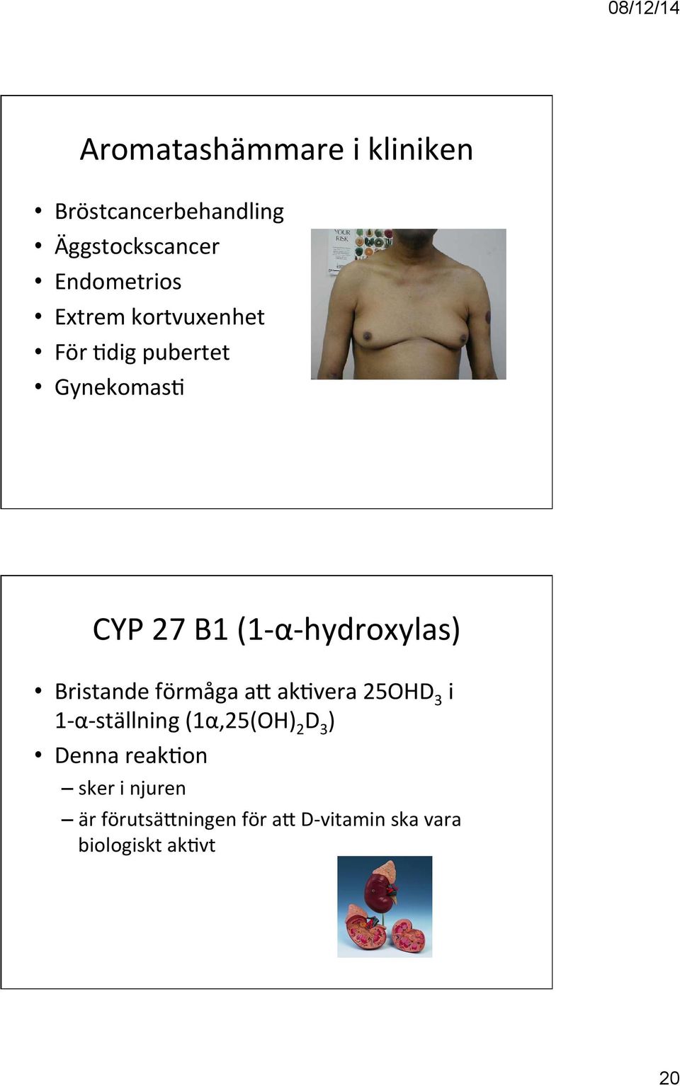 Bristande förmåga af ak2vera 25OHD 3 i 1- α- ställning (1α,25(OH) 2 D 3 ) Denna