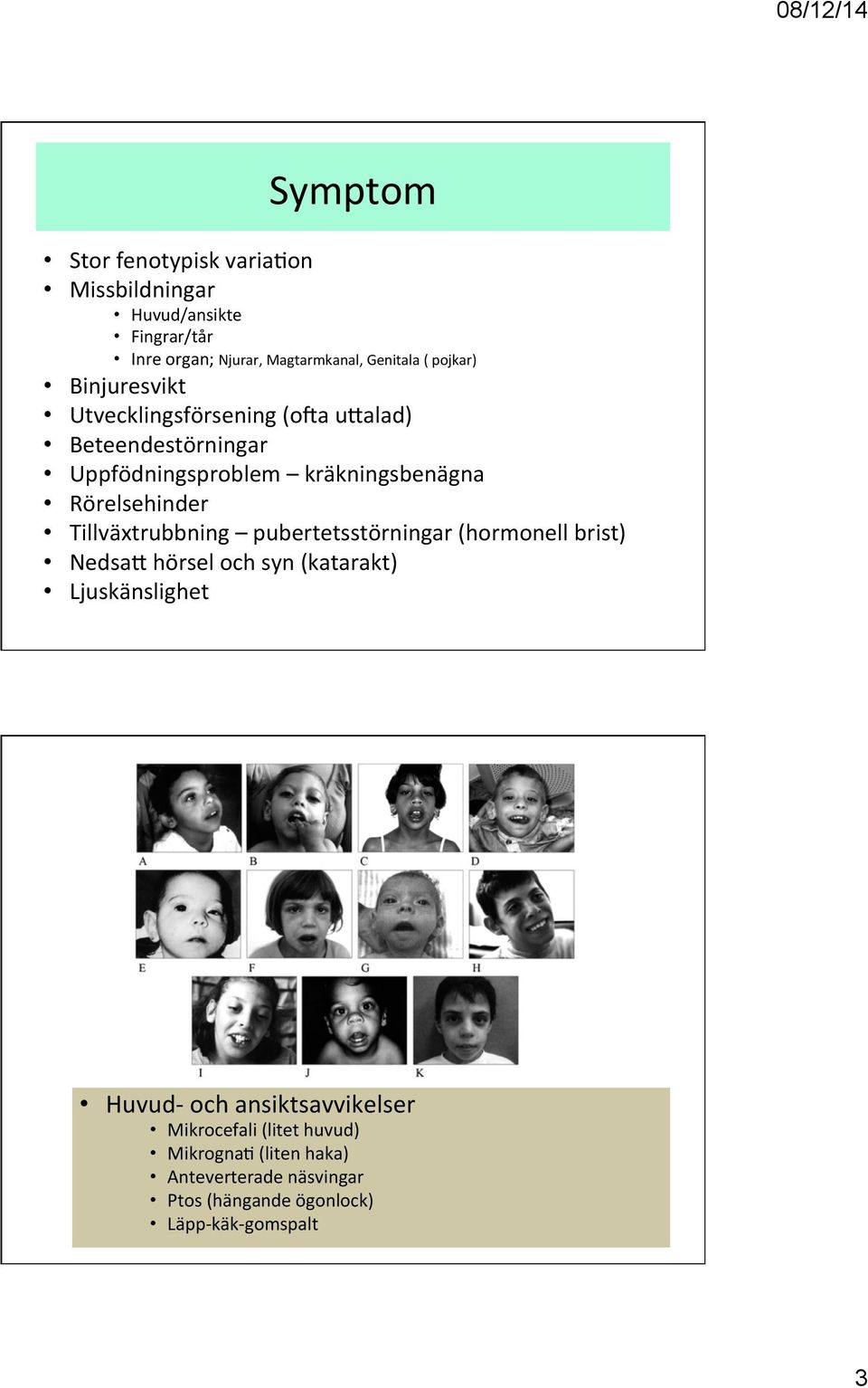 Tillväxtrubbning pubertetsstörningar (hormonell brist) NedsaF hörsel och syn (katarakt) Ljuskänslighet Huvud- och