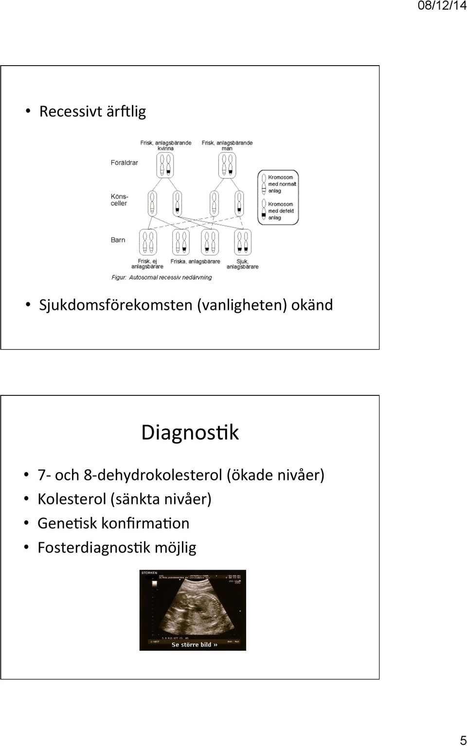 dehydrokolesterol (ökade nivåer) Kolesterol