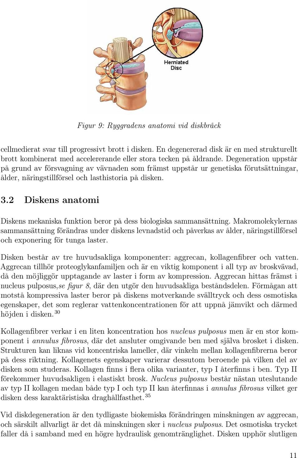 Degeneration uppstår på grund av försvagning av vävnaden som främst uppstår ur genetiska förutsättningar, ålder, näringstillförsel och lasthistoria på disken. 3.