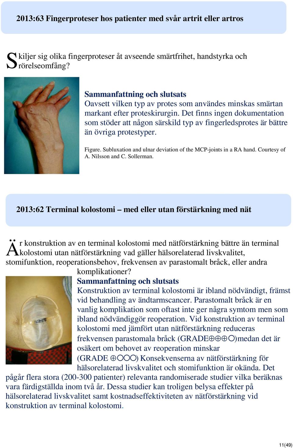 Det finns ingen dokumentation som stöder att någon särskild typ av fingerledsprotes är bättre än övriga protestyper. Figure. Subluxation and ulnar deviation of the MCP-joints in a RA hand.