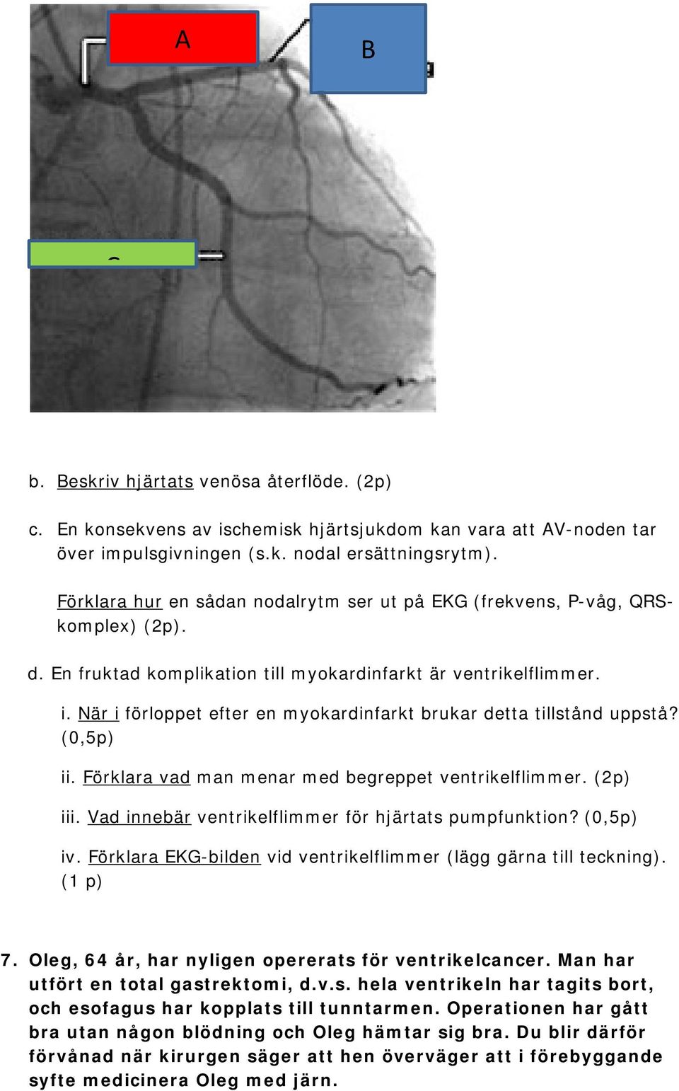 När i förloppet efter en myokardinfarkt brukar detta tillstånd uppstå? (0,5p) ii. Förklara vad man menar med begreppet ventrikelflimmer. (2p) iii.