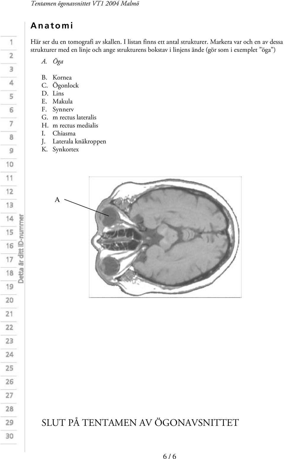 (gör som i exemplet öga ) A. Öga B. Kornea C. Ögonlock D. Lins E. Makula F. Synnerv G.