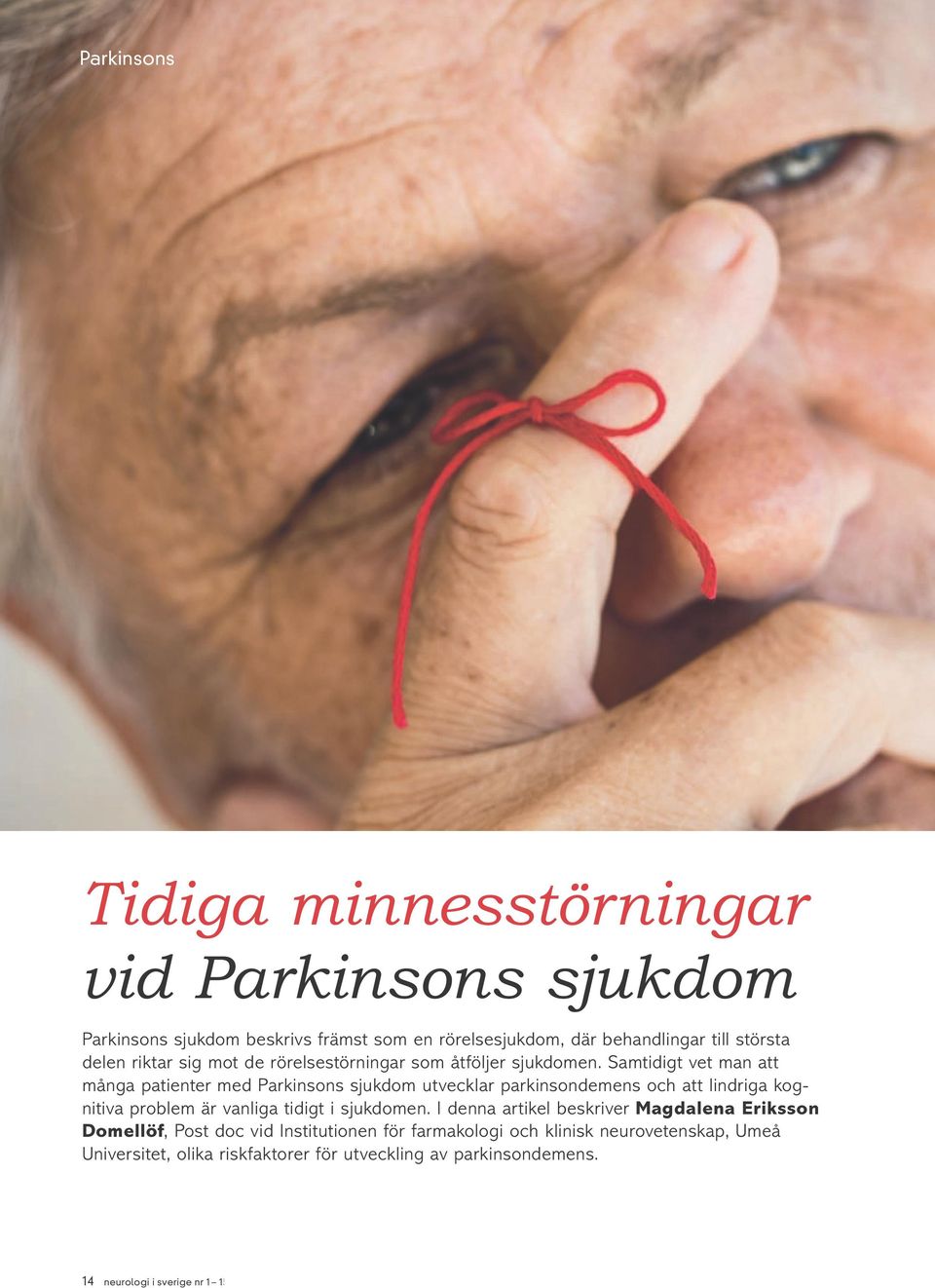 Samtidigt vet man att många patienter med Parkinsons sjukdom utvecklar parkinsondemens och att lindriga kognitiva problem är vanliga tidigt i