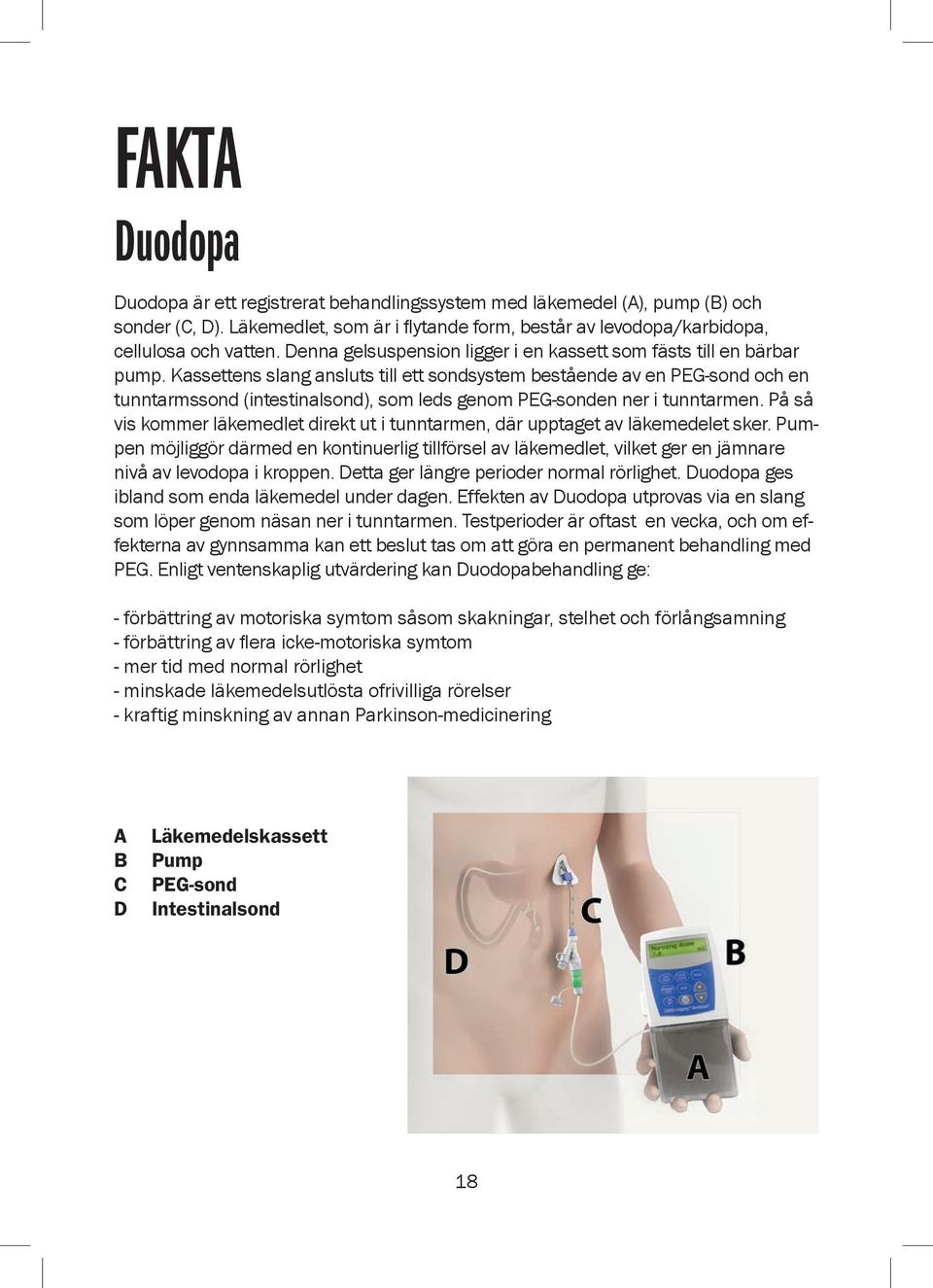 Kassettens slang ansluts till ett sondsystem bestående av en PEG-sond och en tunntarmssond (intestinalsond), som leds genom PEG-sonden ner i tunntarmen.