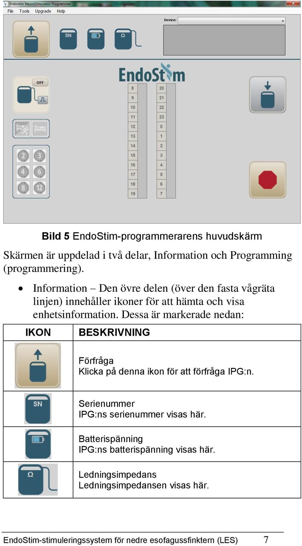 Dessa är markerade nedan: IKON BESKRIVNING Förfråga Klicka på denna ikon för att förfråga IPG:n.