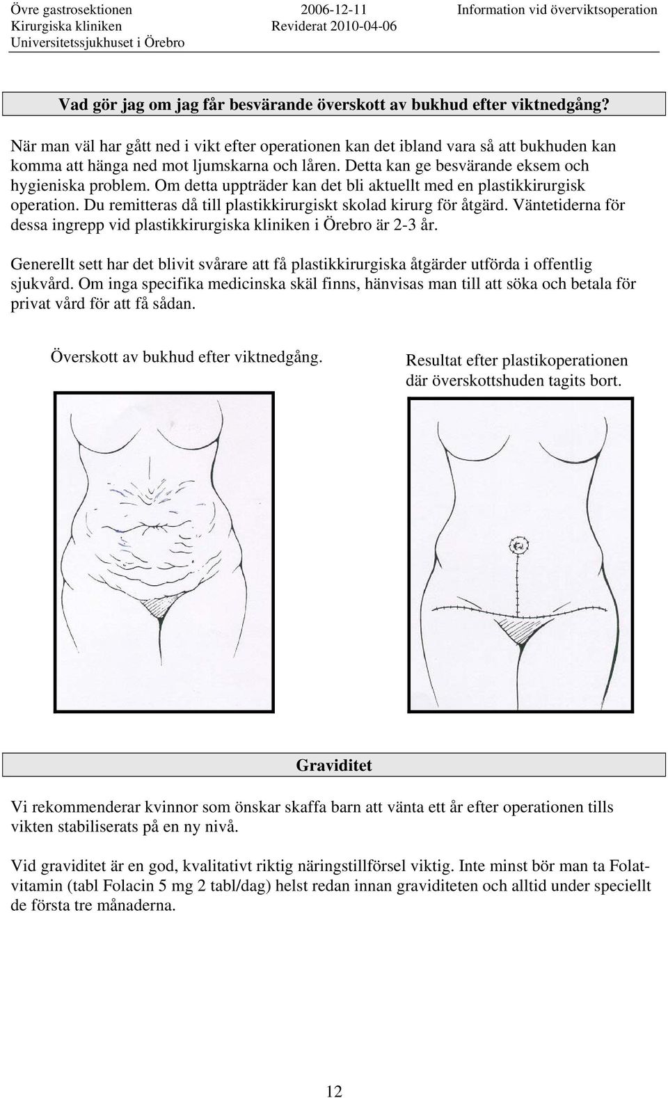 Om detta uppträder kan det bli aktuellt med en plastikkirurgisk operation. Du remitteras då till plastikkirurgiskt skolad kirurg för åtgärd.