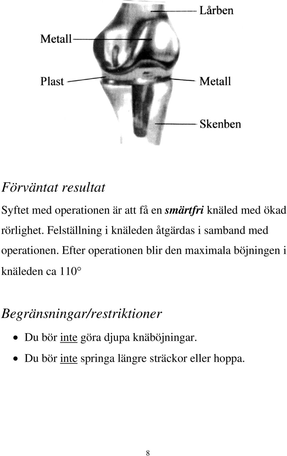 Efter operationen blir den maximala böjningen i knäleden ca 110