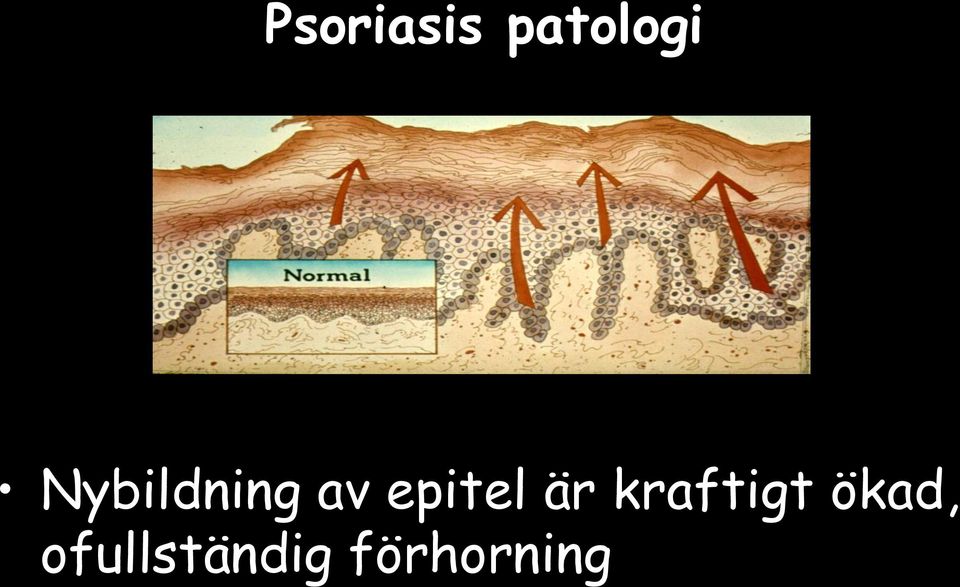 är kraftigt ökad,