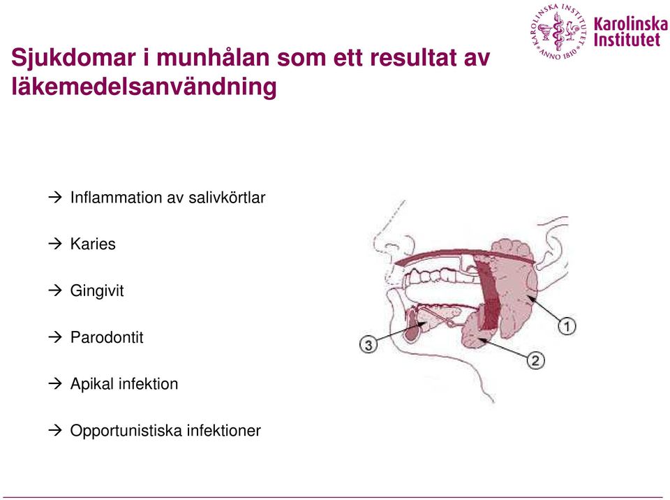 salivkörtlar Karies Gingivit Parodontit