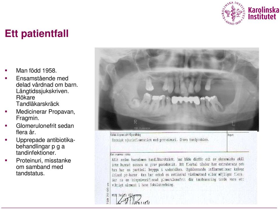 Rökare Tandläkarskräck Medicinerar Propavan, Fragmin.