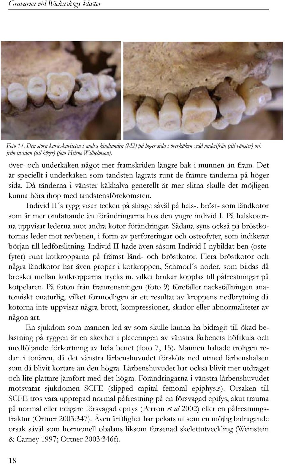 Då tänderna i vänster käkhalva generellt är mer slitna skulle det möjligen kunna höra ihop med tandstensförekomsten.