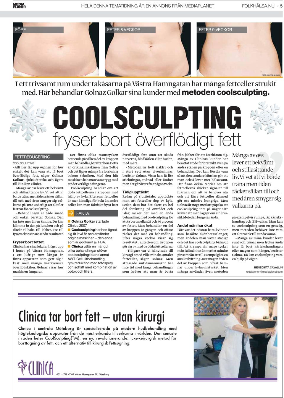 COOLSCULPTING fryser bort överfl ödigt fett FOTO: EDWARD BECKER FETTREDUCERING COOLSCULPTING Allt fler får upp ögonen för hur enkelt det kan vara att få bort överflödigt fett, säger Golnaz Golkar,