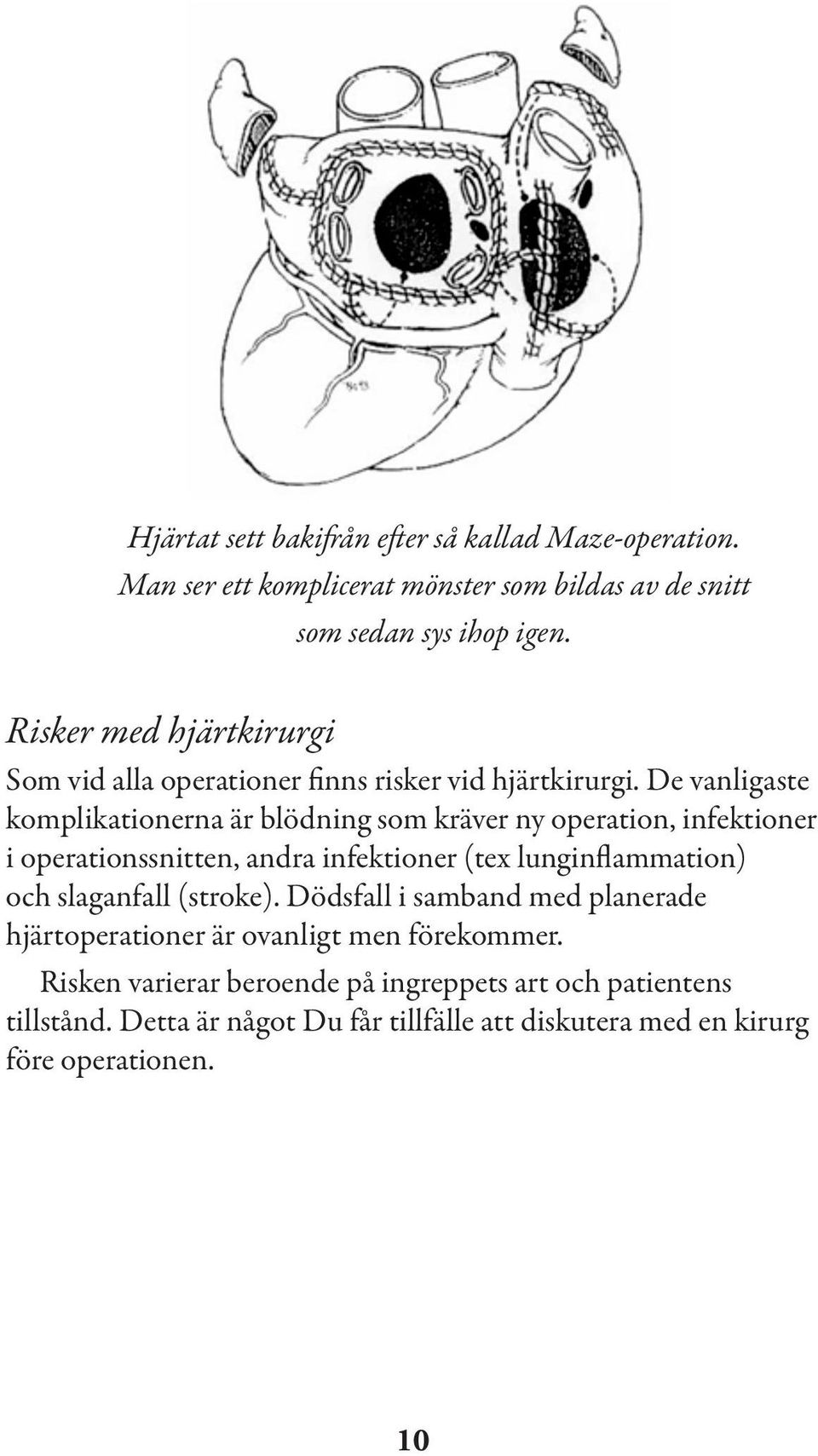 De vanligaste komplikationerna är blödning som kräver ny operation, infektioner i operationssnitten, andra infektioner (tex lunginflammation) och