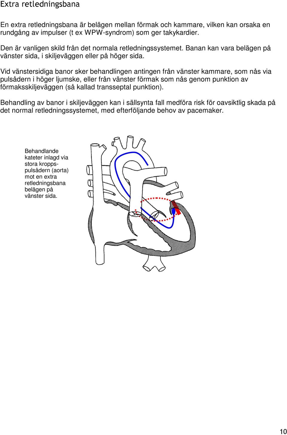 Vid vänstersidiga banor sker behandlingen antingen från vänster kammare, som nås via pulsådern i höger ljumske, eller från vänster förmak som nås genom punktion av förmaksskiljeväggen (så kallad