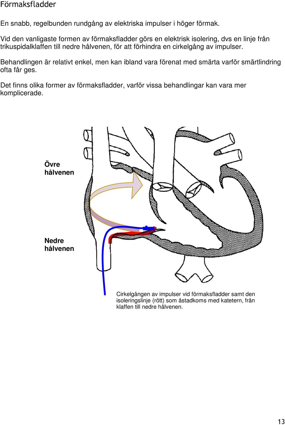 cirkelgång av impulser. Behandlingen är relativt enkel, men kan ibland vara förenat med smärta varför smärtlindring ofta får ges.