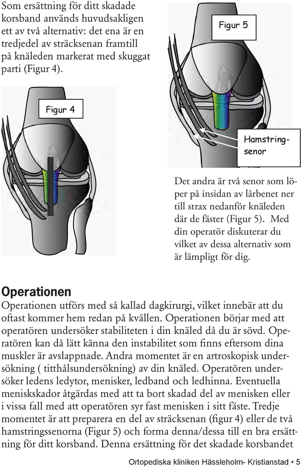 Med din operatör diskuterar du vilket av dessa alternativ som är lämpligt för dig. Operationen Operationen utförs med så kallad dagkirurgi, vilket innebär att du oftast kommer hem redan på kvällen.