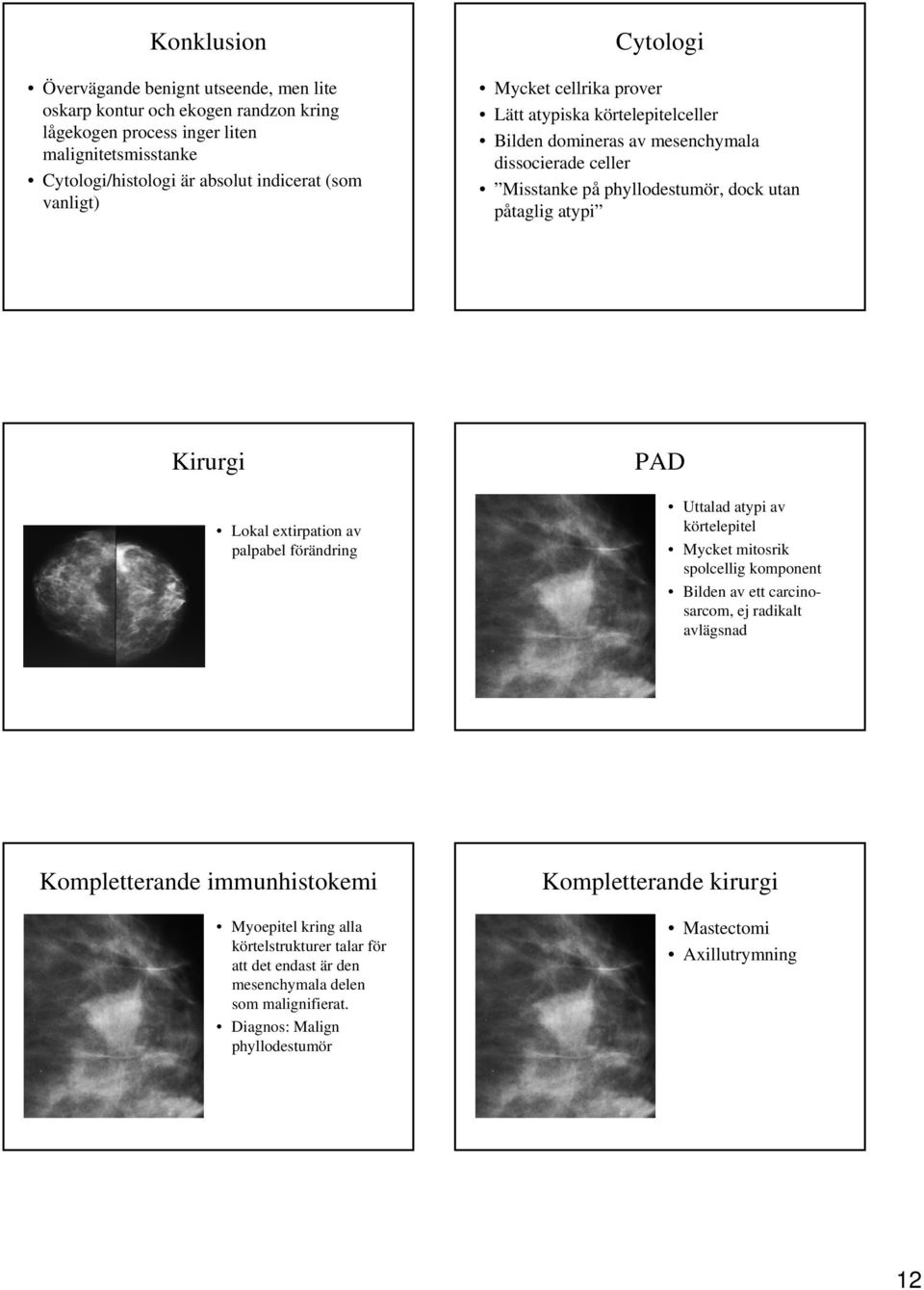 Lokal extirpation av palpabel förändring PAD Uttalad atypi av körtelepitel Mycket mitosrik spolcellig komponent Bilden av ett carcinosarcom, ej radikalt avlägsnad Kompletterande