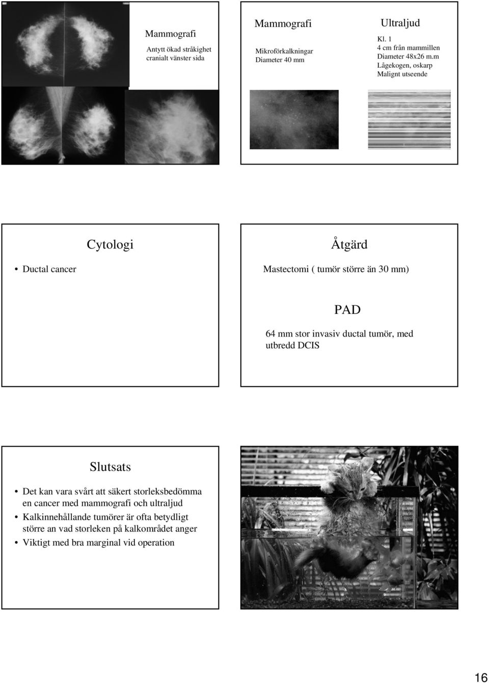 m Lågekogen, oskarp Malignt utseende Cytologi Åtgärd Ductal cancer Mastectomi ( tumör större än 30 mm) PAD 64 mm stor invasiv ductal