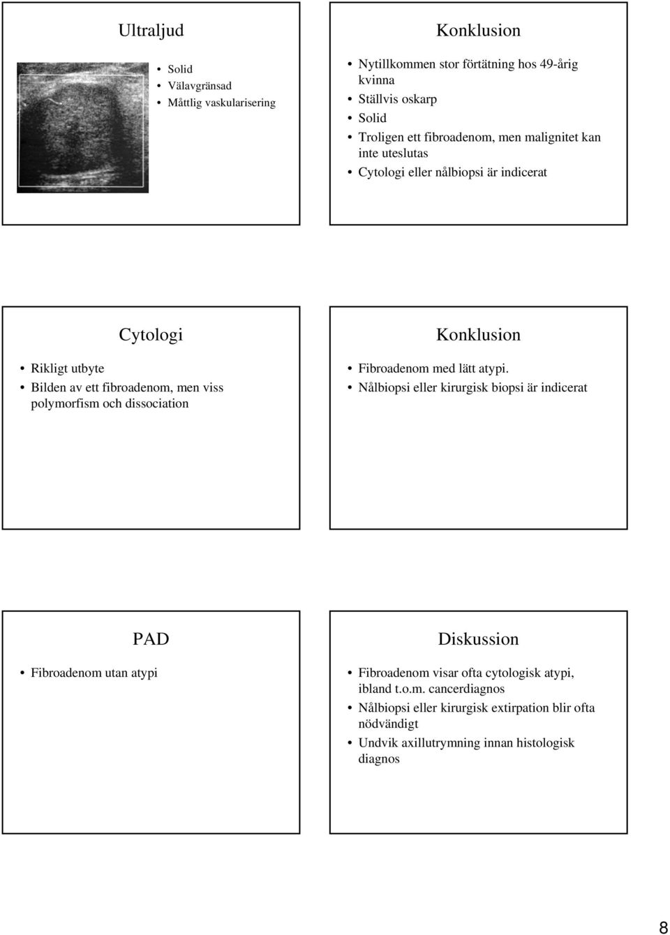 polymorfism och dissociation Konklusion Fibroadenom med lätt atypi.