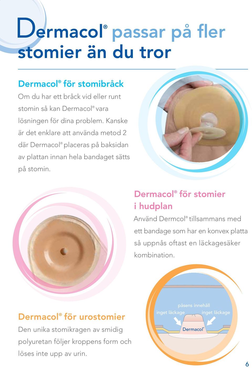 Dermacol för stomier i hudplan Använd Dermcol tillsammans med ett bandage som har en konvex platta så uppnås oftast en läckagesäker kombination.