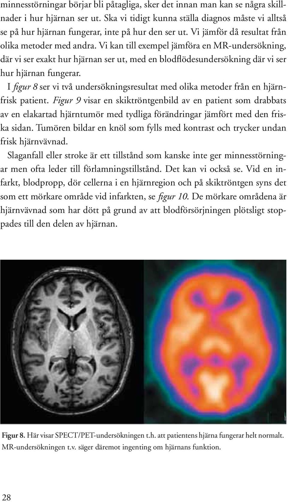 Vi kan till exempel jämföra en MR-undersökning, där vi ser exakt hur hjärnan ser ut, med en blodflödesundersökning där vi ser hur hjärnan fungerar.