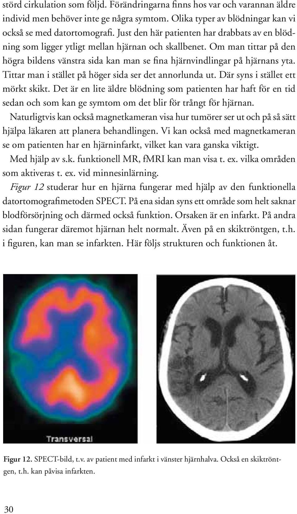 Tittar man i stället på höger sida ser det annorlunda ut. Där syns i stället ett mörkt skikt.