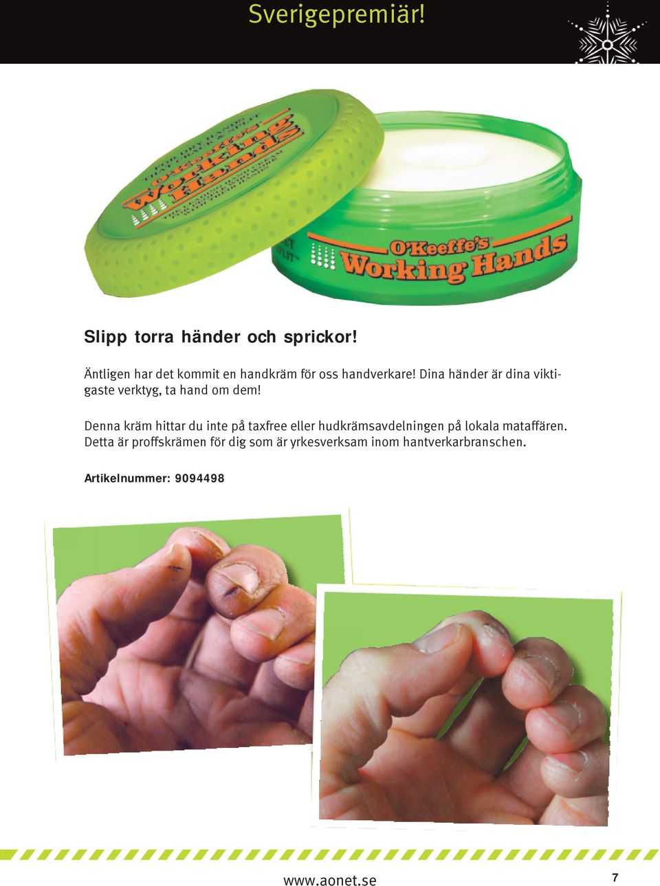 Dina händer är dina viktigaste verktyg, ta hand om dem!